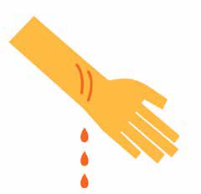 <p>Young Minds - Self Harm Support</p>